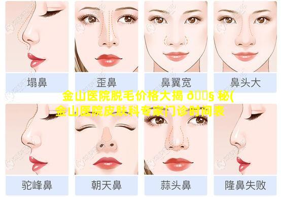 金山医院脱毛价格大揭 🐧 秘(金山医院皮肤科专家门诊时间表 🐼 )